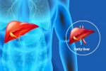 Fatty Liver Disease News news, Fatty Liver Disease News body, body organs that can be affected by fatty liver disease, News updates