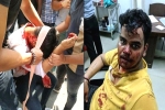 Harsh Yadav attack, Amity University attack, social media demands justice for two noida students who are brutally attacked, Feminism