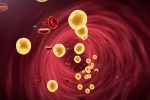 Cholesterol tips, Cholesterol medication, tips to lower cholesterol when statins don t work, Drugs