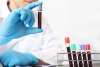 A Simple Blood Test That Can Detect Cancer