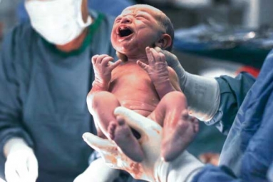 C-Section Deliveries Nearly Doubled Worldwide Since 2000: Study