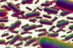 E.coli Outbreak deaths, E.coli Outbreak symptoms, all about e coli outbreak in the united kingdom, Antibiotics