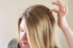 Itchy scalp, Shampoo, remedies to get rid of itchy scalp, Itchy scalp Itchy scalp, Shampoo, remedies to get rid of itchy scalp, Itchy scalp