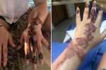 black henna side effects, fashion and beauty, henna tattoo cause aussie woman to almost lose her hand, Tattoos